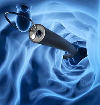 ポリープなどが見つかった場合その場で日帰り切除が可能