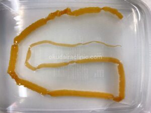 捕獲直後のサナダムシ。生理食塩水中で緩やかにうごめいていた。