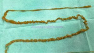 うごめくサナダムシ。大気に触れたためか、激しくシュリンクしている。